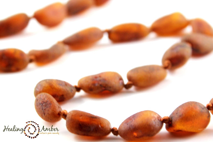 Baltic Amber Bracelet/Anklet - 5.5"