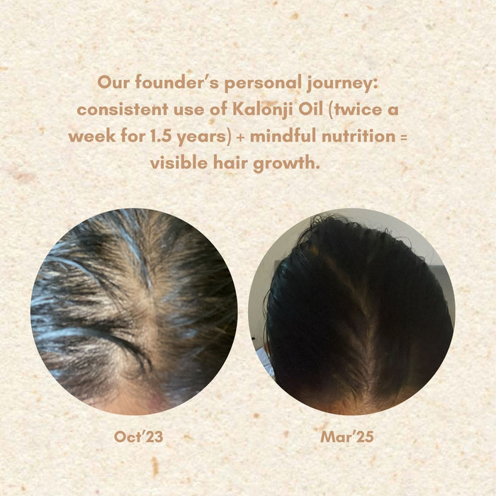 before and after picture of scalp showing results of Kalonji Oil for hair growth