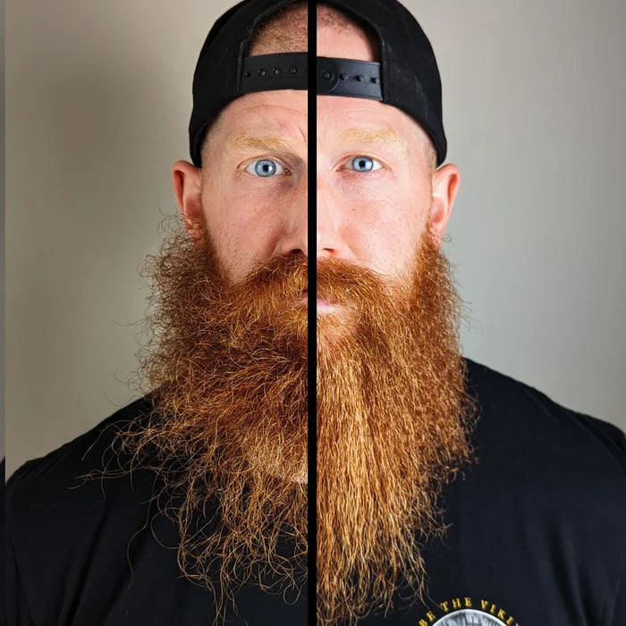 Ultimate Carbon X Beard Kit, image 2. The Beard Struggle