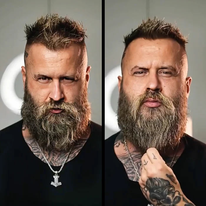 Ultimate Carbon X Beard Kit, image 3. The Beard Struggle